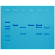 Cholesterol Diagnostics